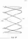Fig. 22 - METHODS AND APPARATUS FOR ANCHORING WITHIN THE GASTROINTESTINAL TRACT
