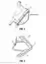 Fig. 03 - METHODS OF PERFORMING A BARIATRIC PROCEDURE AND SURGICAL DEVICES FOR USE THEREWITH