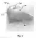 Fig. 07 - SWEAT PAD AND METHODS OF USING SAME