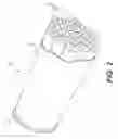 Fig. 03 - Orthotic device for assisting limb movement
