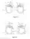 Fig. 09 - Nasal dilator devices