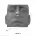 Fig. 10 - Nasal dilator devices