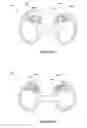 Fig. 11 - Nasal dilator devices