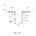 Fig. 14 - Nasal dilator devices