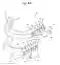 Fig. 02 - Oral orthotic systems, devices and methods for use in connection with sleep-disordered breathing
