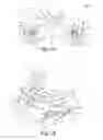 Fig. 10 - Oral orthotic systems, devices and methods for use in connection with sleep-disordered breathing