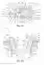 Fig. 14 - Oral orthotic systems, devices and methods for use in connection with sleep-disordered breathing