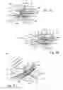 Fig. 18 - Oral orthotic systems, devices and methods for use in connection with sleep-disordered breathing