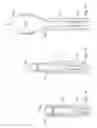 Fig. 05 - Devices and methods for a cannula-delivered treatment material application device