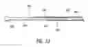 Fig. 27 - Intraocular shunt insertion techniques