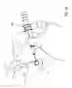 Fig. 02 - Intraocular shunt inserter