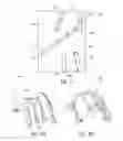 Fig. 09 - Intraocular shunt inserter