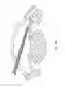 Fig. 04 - Intraocular shunt implantation methods and devices