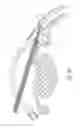 Fig. 09 - Intraocular shunt implantation methods and devices