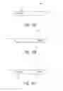 Fig. 18 - Intraocular shunt implantation methods and devices