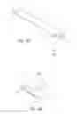 Fig. 23 - Intraocular shunt implantation methods and devices