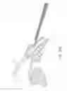 Fig. 37 - Intraocular shunt implantation methods and devices