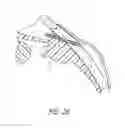 Fig. 45 - Intraocular shunt implantation methods and devices