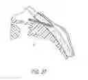 Fig. 46 - Intraocular shunt implantation methods and devices