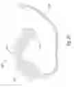 Fig. 22 - Tampon assembly providing proper bodily placement of pledget