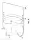 Fig. 06 - Two-part non-planar graduated compression device for the treatment of circulatory disorders
