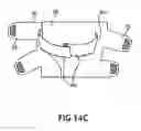 Fig. 20 - Two-part non-planar graduated compression device for the treatment of circulatory disorders