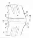 Fig. 22 - Two-part non-planar graduated compression device for the treatment of circulatory disorders