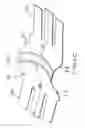 Fig. 23 - Two-part non-planar graduated compression device for the treatment of circulatory disorders