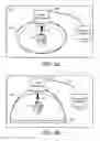 Fig. 05 - Compact electro-mechanical chest compression drive