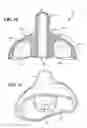 Fig. 19 - Child feeding system