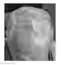 Fig. 01 - Method of using a hair growth product