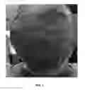 Fig. 02 - Method of using a hair growth product