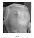 Fig. 03 - Method of using a hair growth product