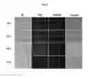 Fig. 04 - Silica nanoparticle composition for delivering bioactive material or protein such as a human proteasome