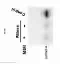 Fig. 37 - Silica nanoparticle composition for delivering bioactive material or protein such as a human proteasome