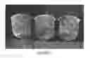 Fig. 02 - Loadable polymeric particles for therapeutic and/or diagnostic applications and methods of preparing and using the same