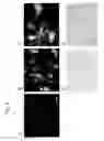 Fig. 04 - Drug delivery particle and method for producing the same