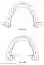 Fig. 05 - Pharmaceutical suspensions containing drug particles, devices for their administration, and methods of their use