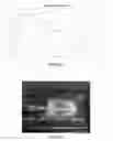 Fig. 37 - Pharmaceutical suspensions containing drug particles, devices for their administration, and methods of their use