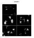 Fig. 08 - METHODS AND COMPOSITIONS FOR TREATMENT OF LIPID STORAGE DISORDERS