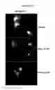 Fig. 13 - METHODS AND COMPOSITIONS FOR TREATMENT OF LIPID STORAGE DISORDERS