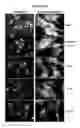 Fig. 16 - METHODS AND COMPOSITIONS FOR TREATMENT OF LIPID STORAGE DISORDERS