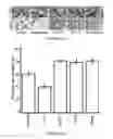 Fig. 15 - INHIBITORS OF LEUKOTRIENE-MEDIATED ACTIVITY FOR TREATING SIDE EFFECTS OF STATIN THERAPY