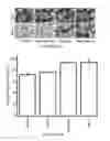 Fig. 16 - INHIBITORS OF LEUKOTRIENE-MEDIATED ACTIVITY FOR TREATING SIDE EFFECTS OF STATIN THERAPY