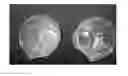 Fig. 01 - Misoprostol dispersible tablet