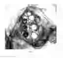 Fig. 02 - Injectable Osteogenic Formulations, and Methods of Use Thereof