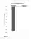 Fig. 12 - Neridronic acid for treating bone marrow lesions
