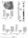 Fig. 04 - METHODS OF ADMINISTERING LMWH