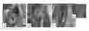 Fig. 01 - HAR-NDS-derived stem cells, method for separating same, and use thereof
