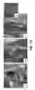 Fig. 02 - HAR-NDS-derived stem cells, method for separating same, and use thereof